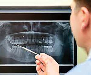 Forensic Odontology: Dental Science in Criminal Investigation