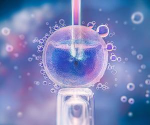 AI in Sperm Sorting: An Unbiased Decision for A Better Outcome