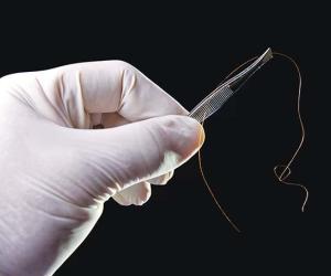 Unlocking Criminal Cases Through Hair Evidence, Forensic Trichology